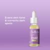 SheaMoisture Melanin Care 4-in-1 Acne Treatment Serum with 2% Salicylic Acid Nourished & Radiant for Calming, Hydrating & Treating Acne, with Niacinamide +Elderberry Complex, 1 fl oz(Even Tone)